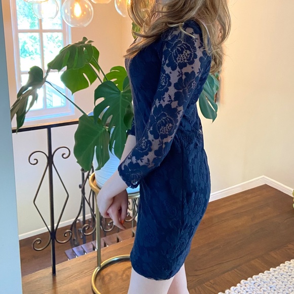 Lace Hollister dress - Picture 2 of 6